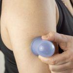 Cupping is Becoming Mainstream for Serious Athletes