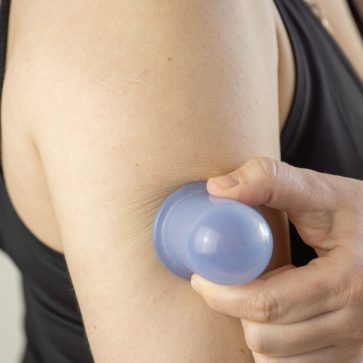 Cupping is Becoming Mainstream for Serious Athletes