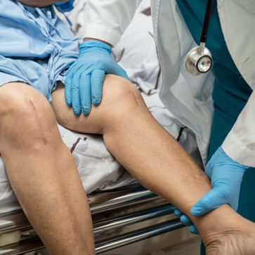 The Importance of Physical Therapy After Knee Surgery